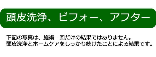 環境保全研究所 髪の毛ケア